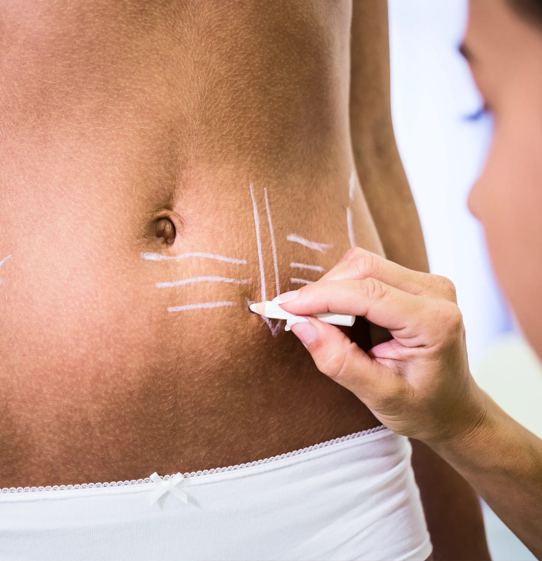 Body Sculpting & Contouring
