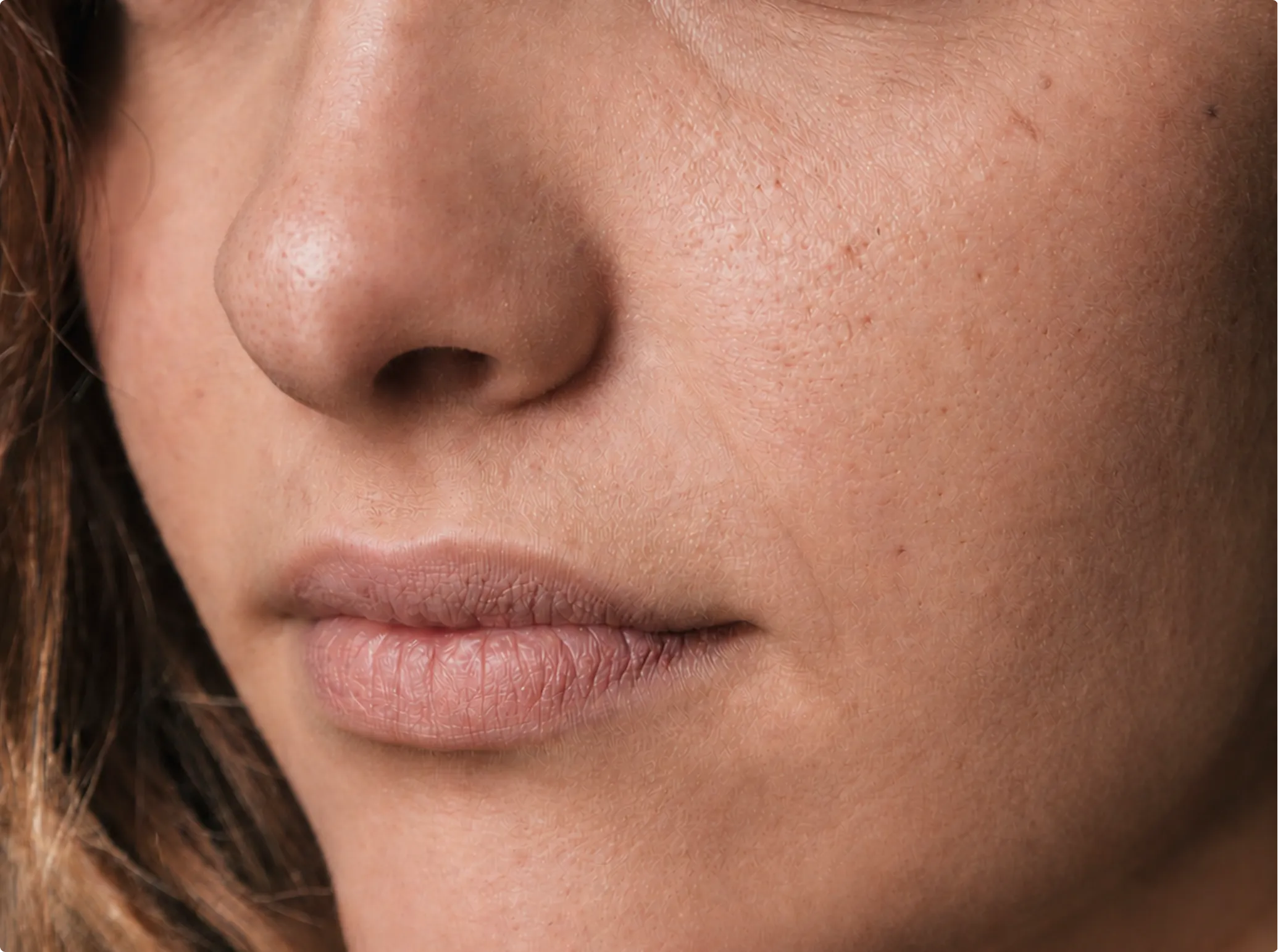 Botox, before