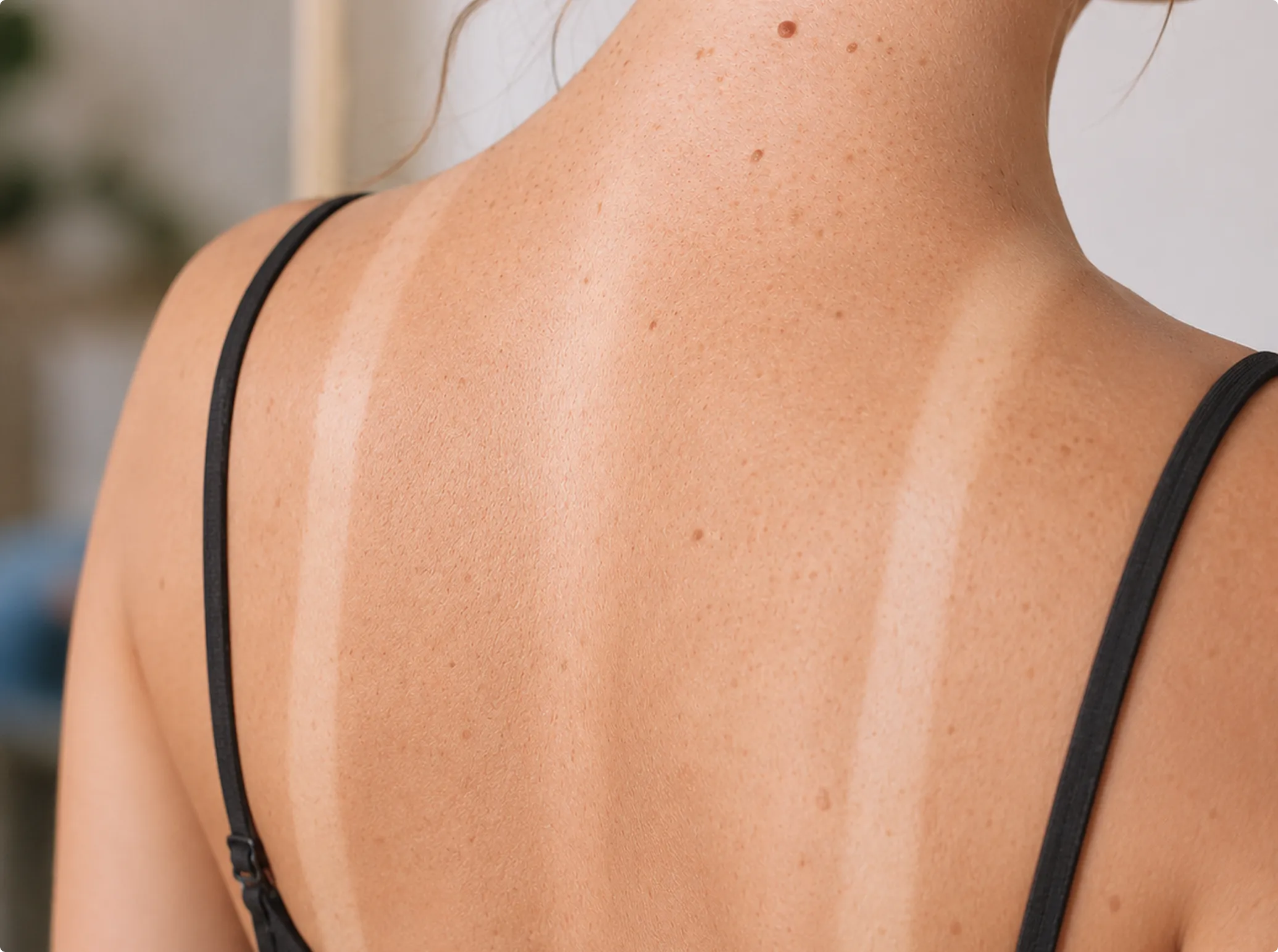 Body Brightening, before