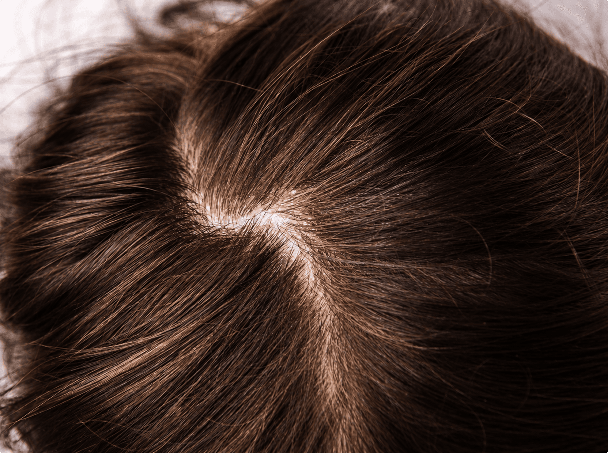 Dermatologists in Chandigarh|Dermatologists in Chandigarh