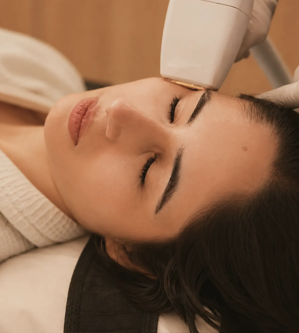 Photofacial (IPL)