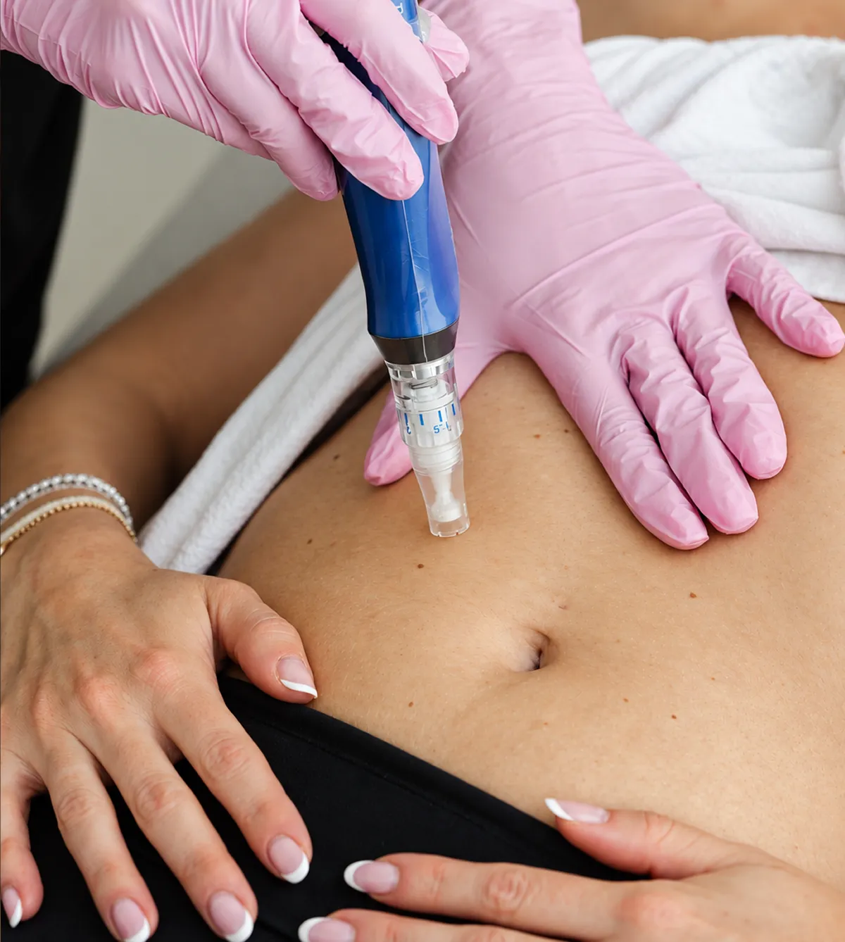 Dermapen