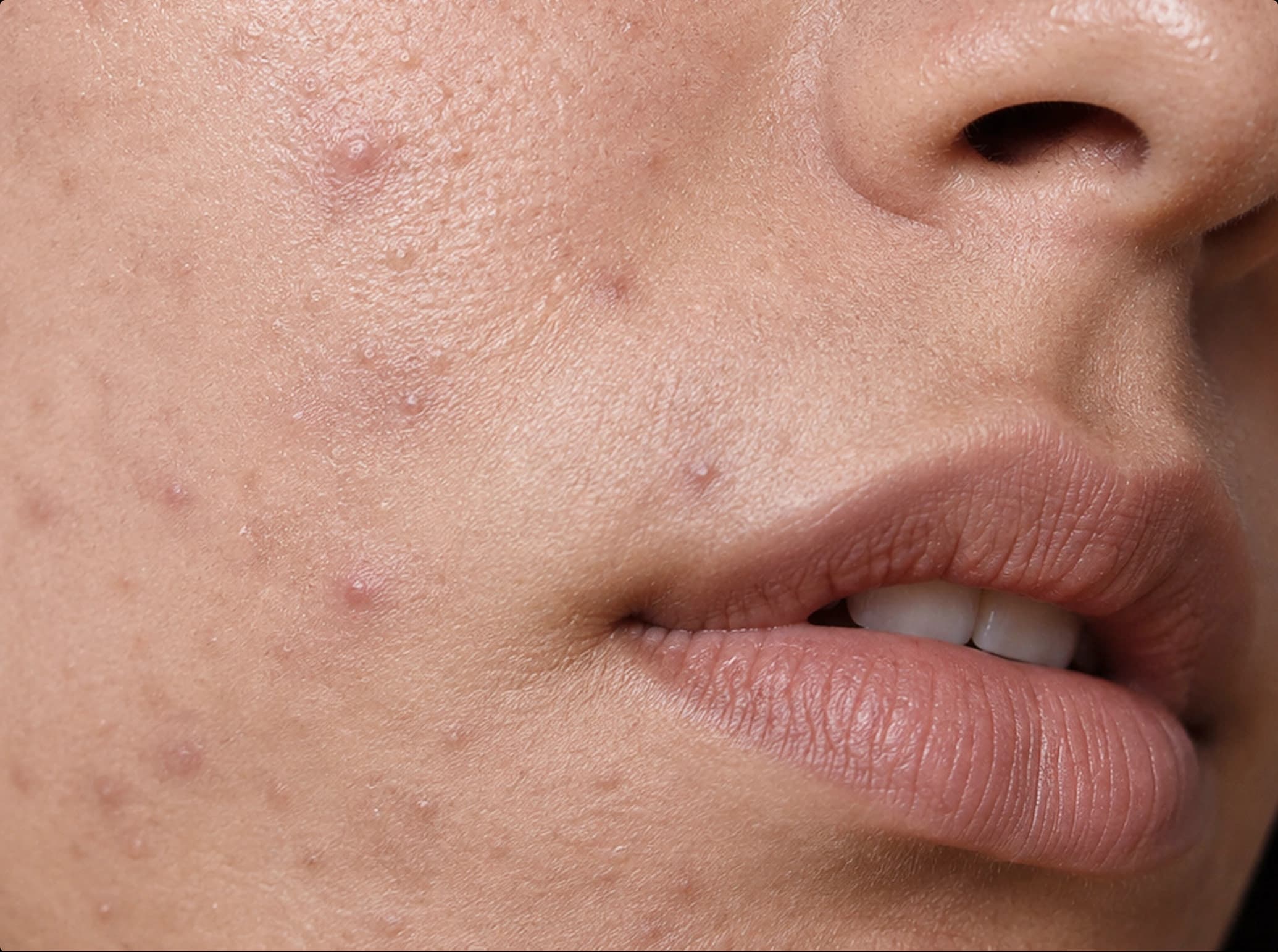 Ageology patient, before
