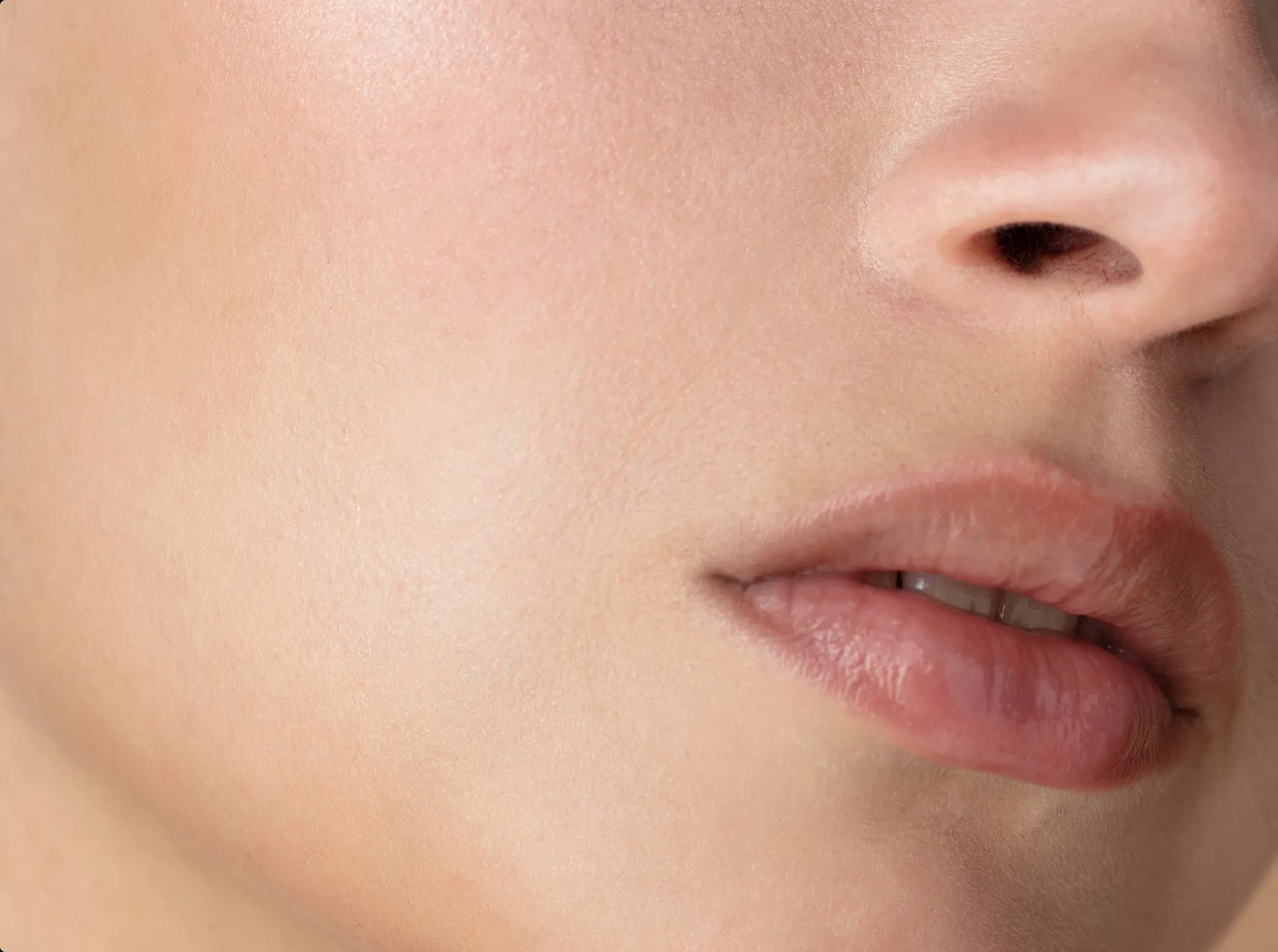 Glow Peel, after