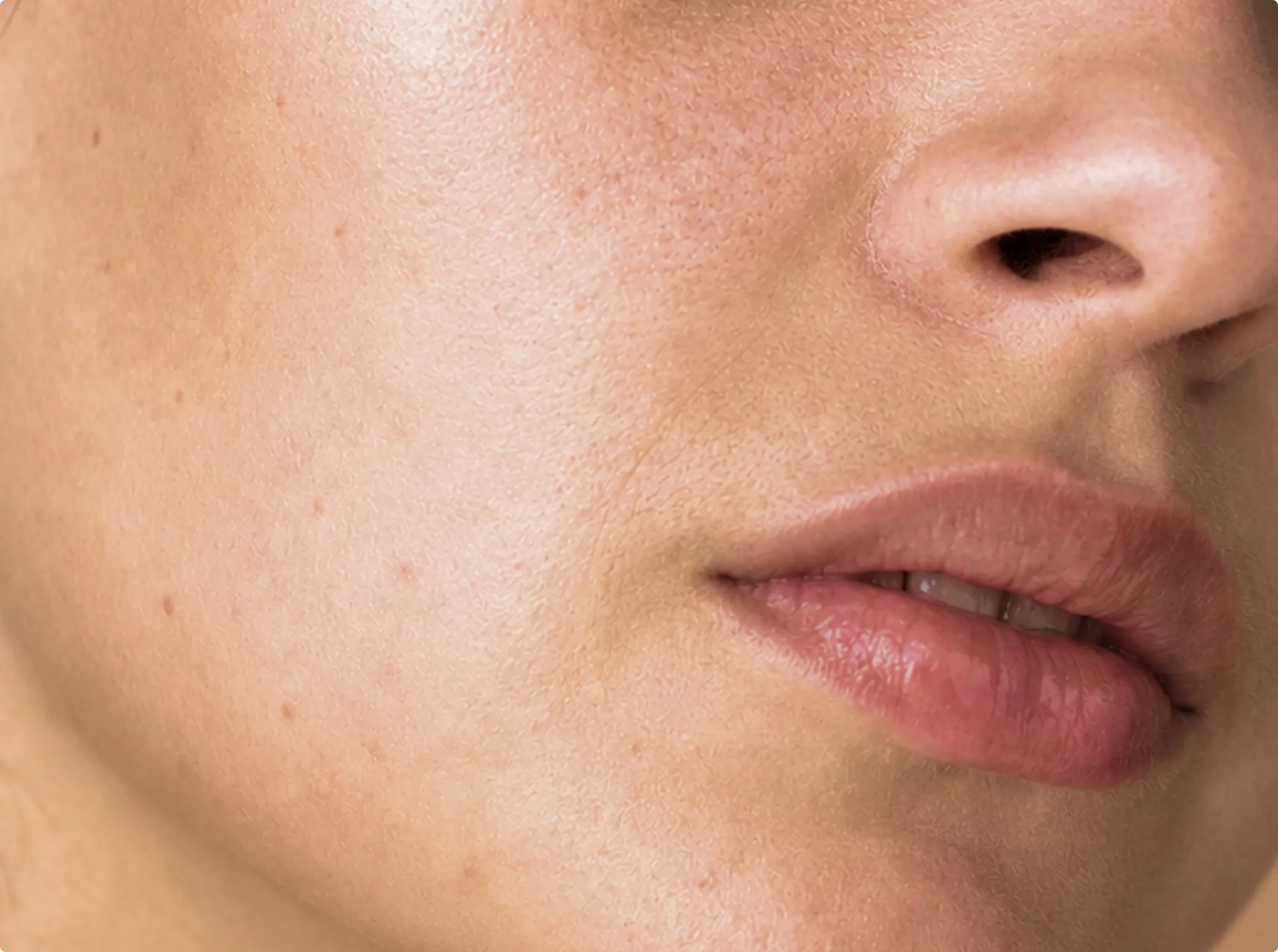 Glow Peel, before