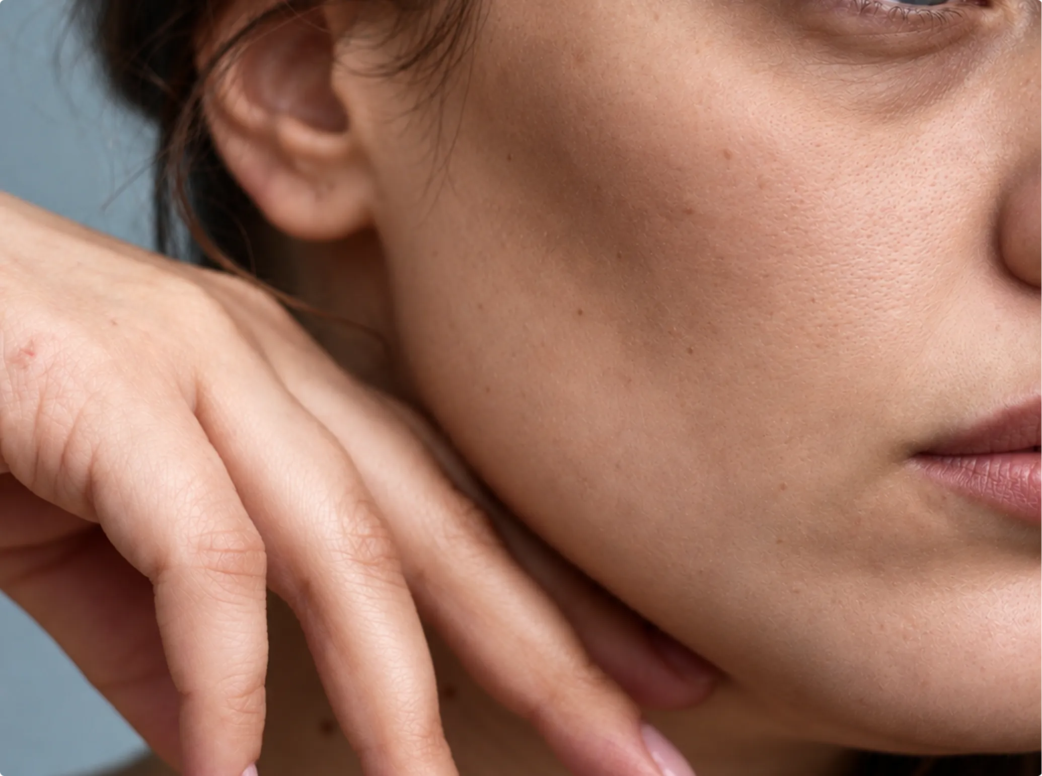 Dermal Fillers, before