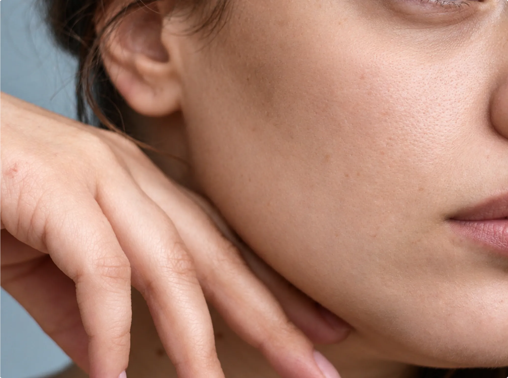 Dermal Fillers, after