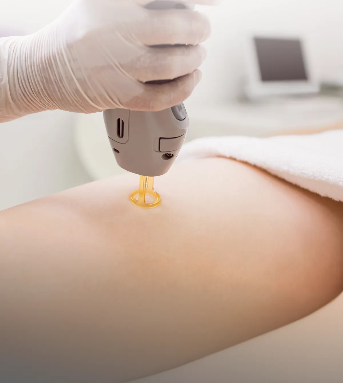 Laser Skin Resurfacing