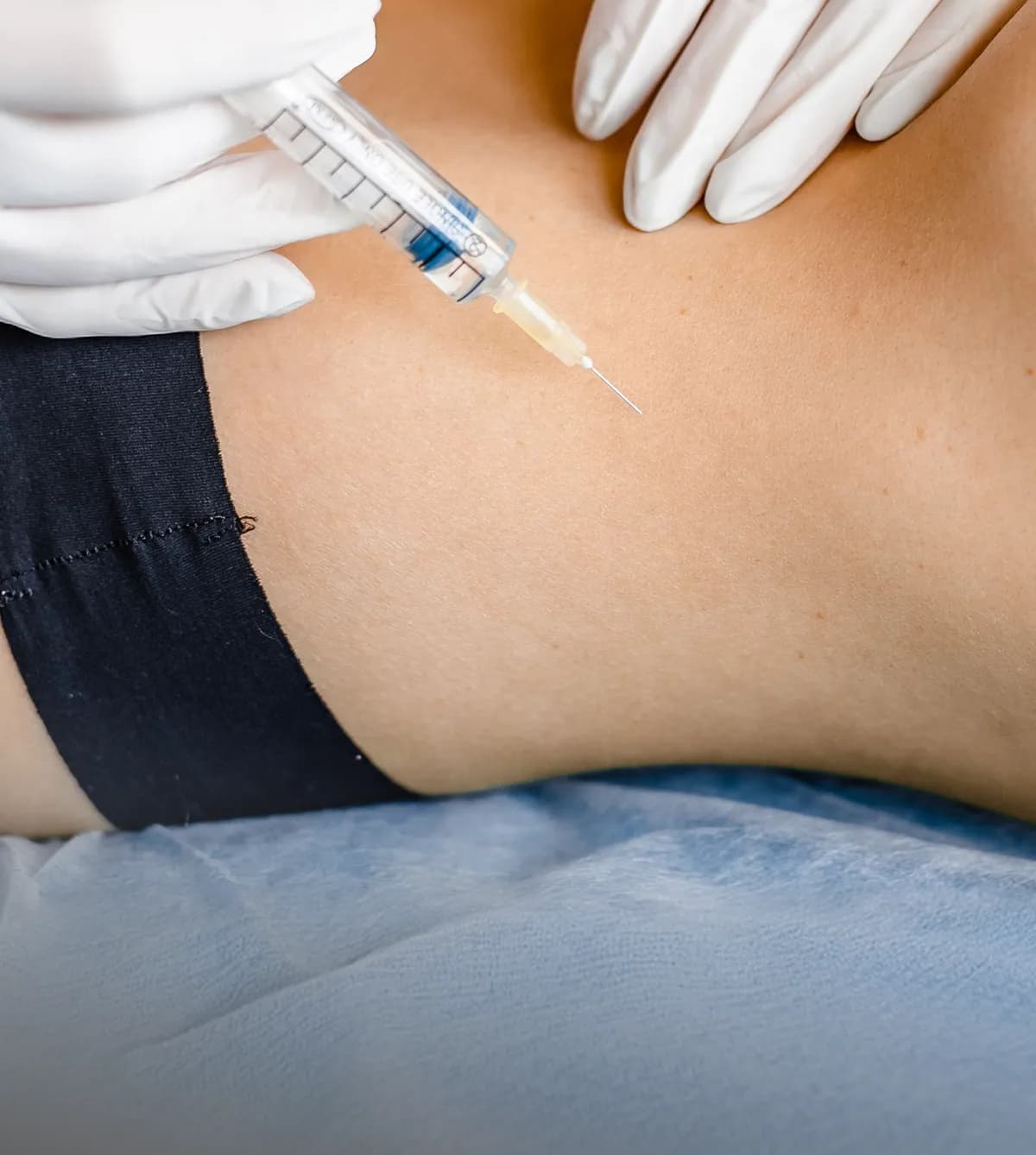 Platelet-Rich Plasma (PRP)