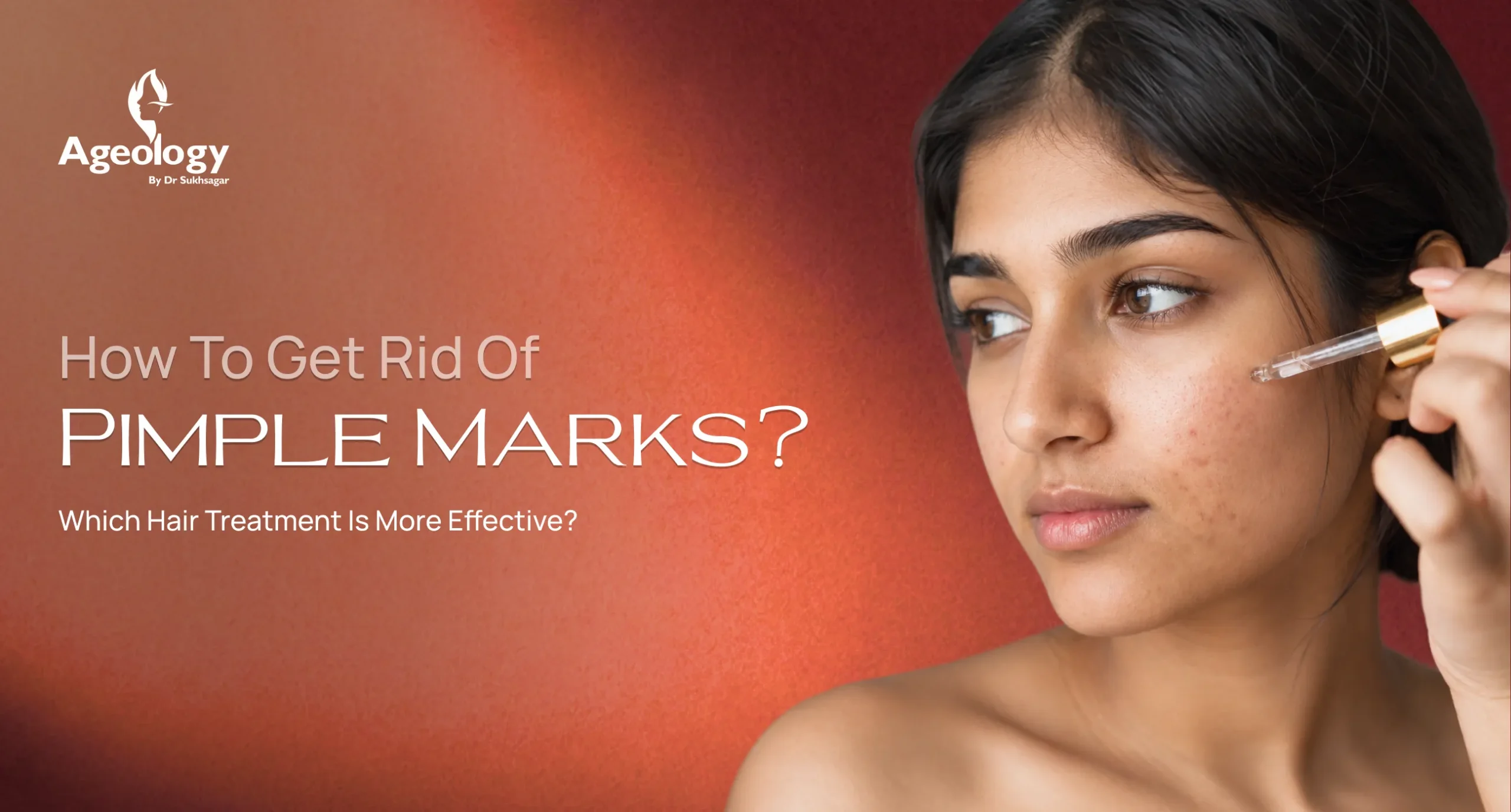 How to Remove Pimple Marks? 10 Expert Tips for Clearer Skin